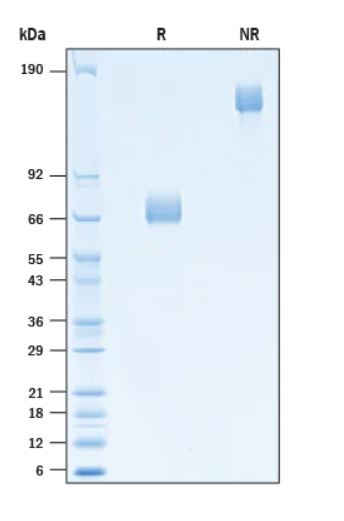 2 μg/lane Protein  was resolved with SDS-PAGE under reducing (R) and non-reducing (NR) conditions and visualized by Coomassie® Blue staining.